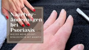 die loesung fuer nagelveraenderungen