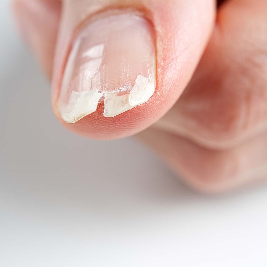 Fussnägel Farben 2025: Die besten Nagellackfarben für Damen und warum