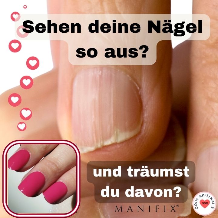 Warum splittern meine Fingernaegel