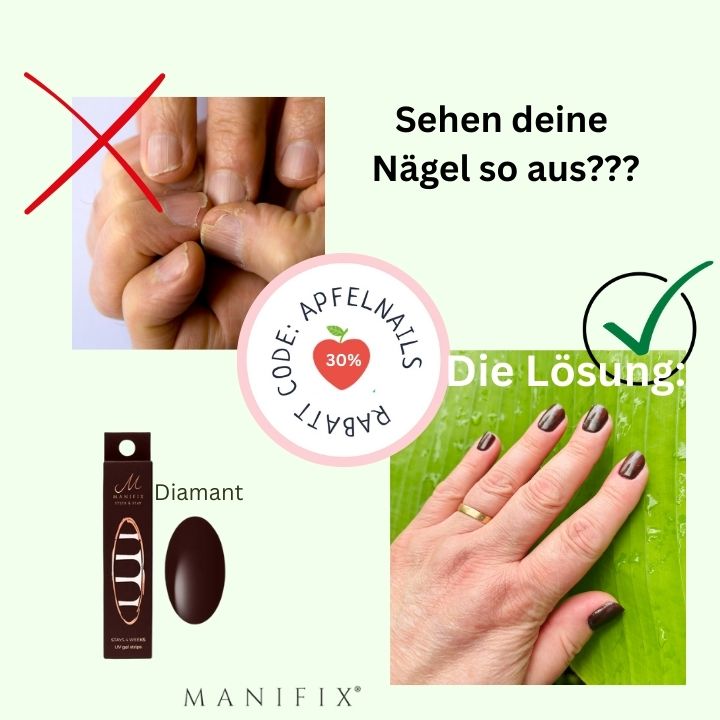 Fingernaegel-eingerissen