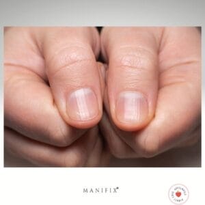 Längsrillen Fingernägel