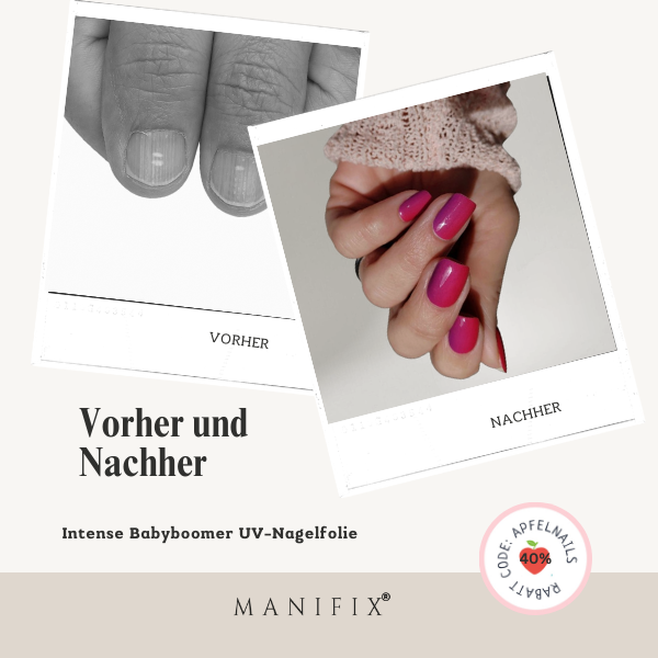 Fingernägel mit Längsrillen Mit UV-Folien wieder schöne Nägel – Nailart & Maniküre Tipps