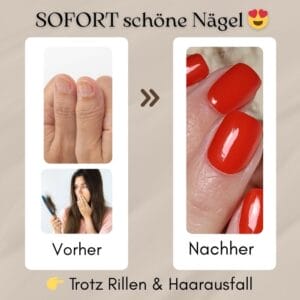 Haarausfall & Rillen in den Nägeln Die optische Lösung und mögliche Ursachen einfach erklärt