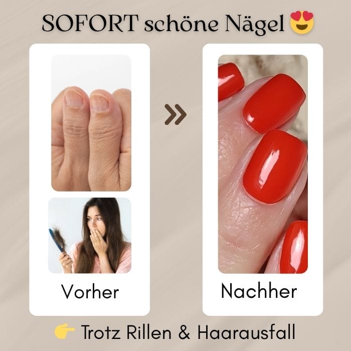 Haarausfall & Rillen in den Nägeln Die optische Lösung und mögliche Ursachen einfach erklärt