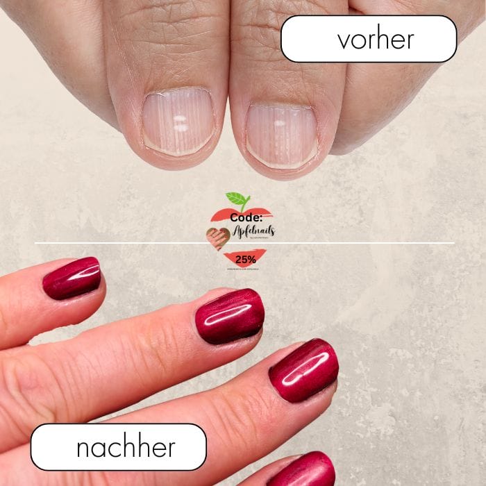 Längsrillen Fingernagel Schilddrüse Ursachen erkennen & trotzdem wunderschöne NägelLängsrillen Fingernagel Schilddrüse Ursachen erkennen & trotzdem wunderschöne Nägel