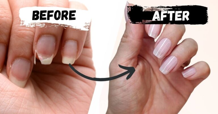 Fingernägel brechen Mangel – vermeide diese fatalen Fehler und rette deine Nägel